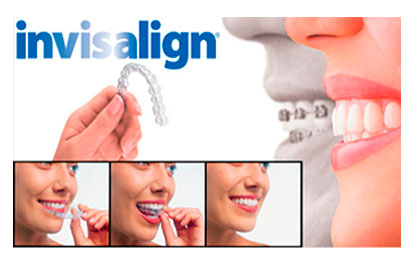 abans